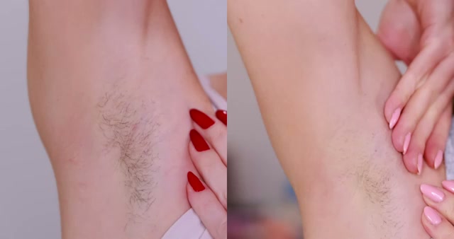 @erinnicoletv reviewing Tria 4X Laser Hair Removal at 13:41 in a YouTube Shorts video