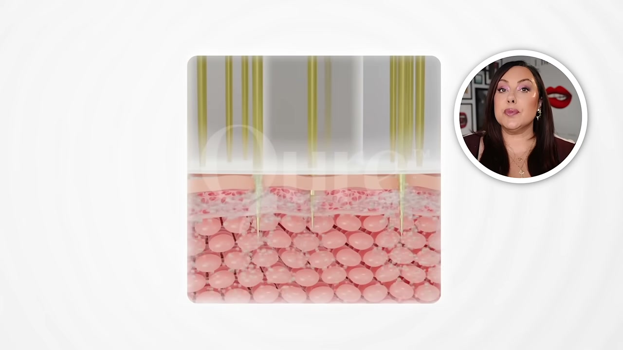 Micro-Infusion System