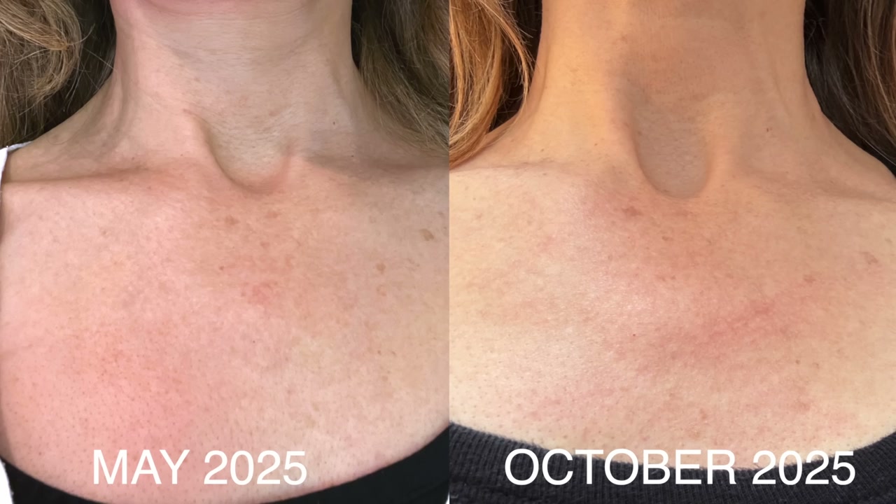 C-Tetra Luxe Vitamin C Serum