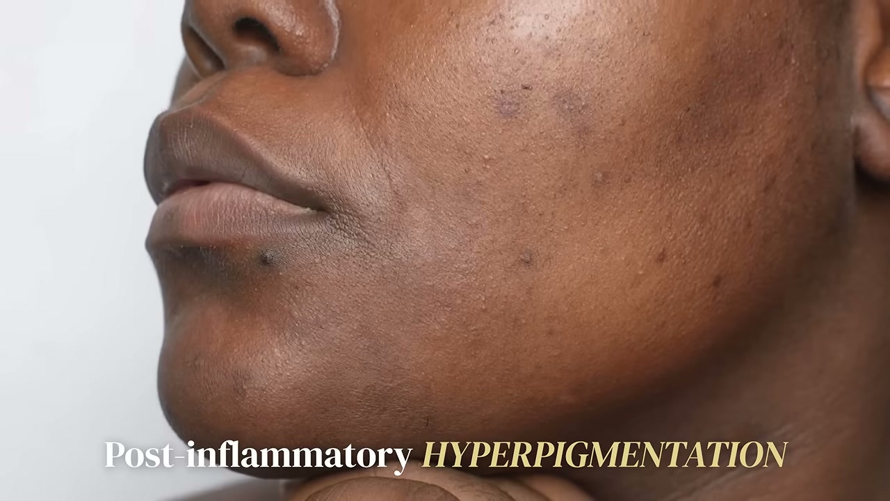 Smooth Slate Ingrown Relief Serum